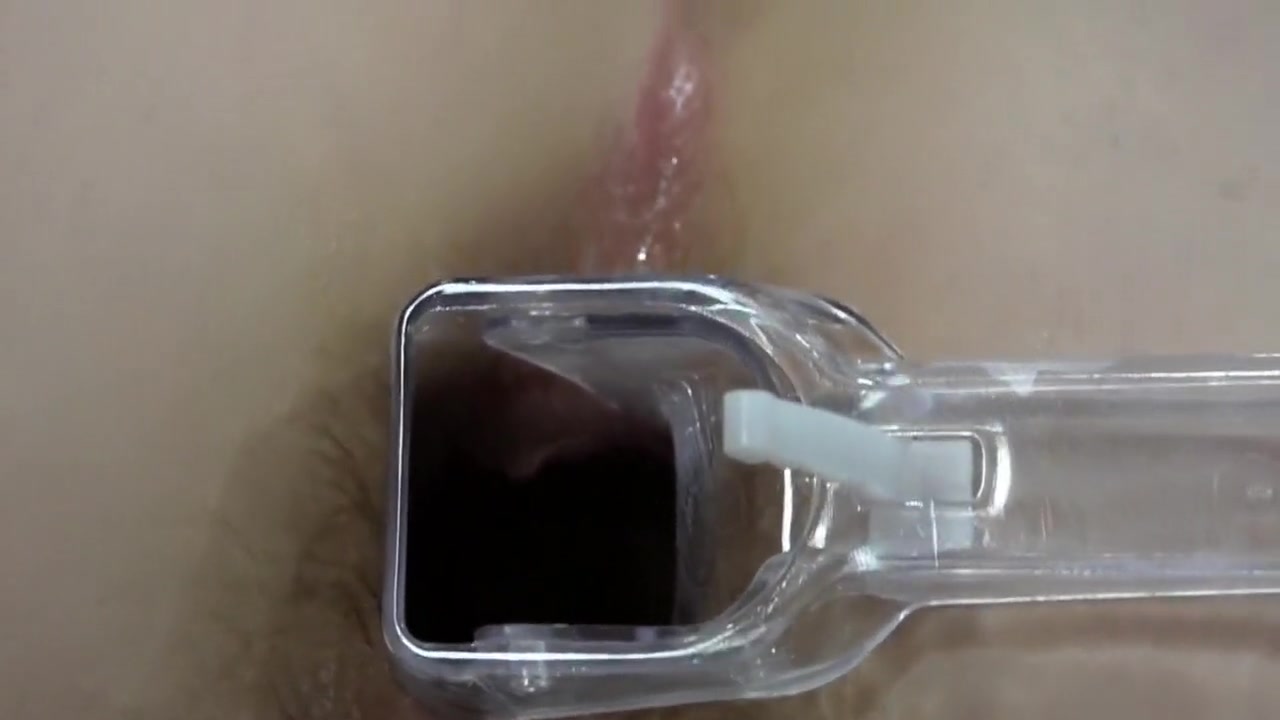 Gynecological Extender In Stretched Anal Hole