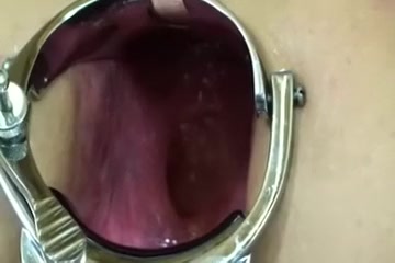 I stretched my wife's chocolate hole with speculum and poked her gut with a stick