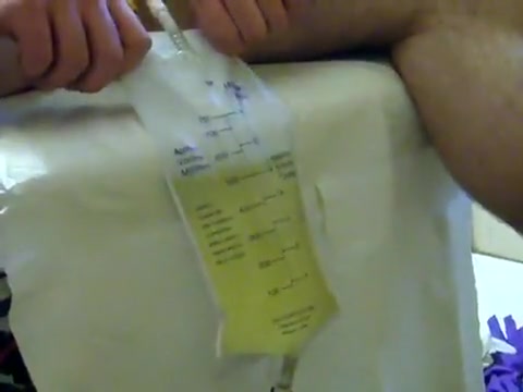 Lee's catheter and bladder drain.